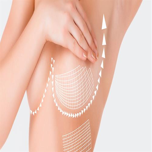 Breast Lift clinicways