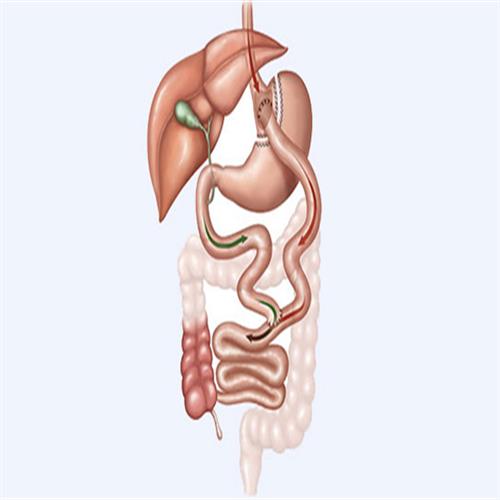 Magenband Revision, clinicways